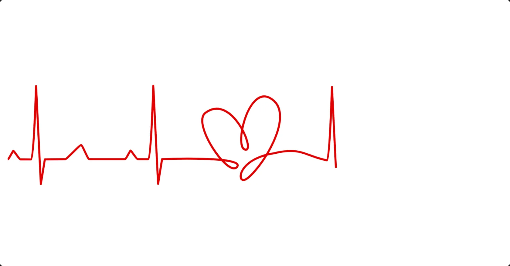 Heart Rate line animation 